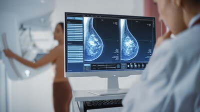 Ein Arzt betrachtet einen Mammographie-Scan. | © AdobeStock_422714239