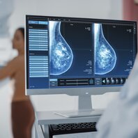 Ein Arzt betrachtet einen Mammographie-Scan. | © AdobeStock_422714239