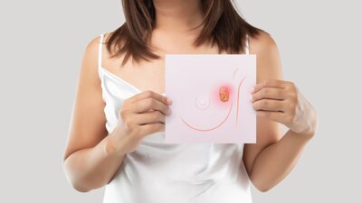 Eine Frau mit einer Darstellung eines Mammakarzinoms. | © AdobeStock_392205899