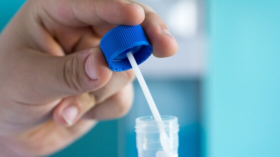 Ein Test auf verstecktes Blut im Stuhl. | © AdobeStock-168669123