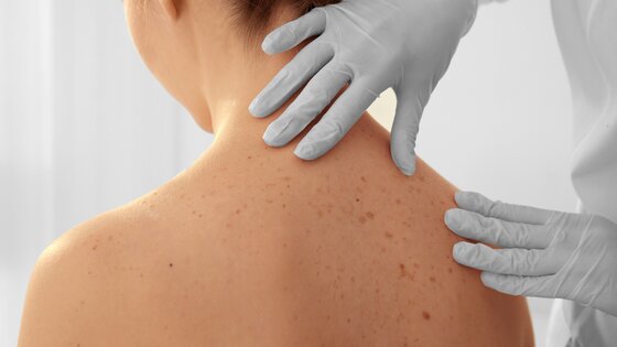 Untersuchung beim Hautarzt | © AdobeStock-142977352