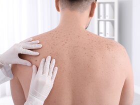 Hautärzt:innen untersuchen die Haut auf Veränderungen | © AdobeStock-246519527