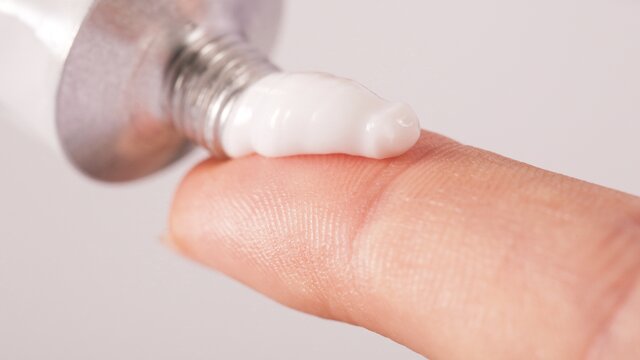 Ein Strang Salbe wird aus einer Tube auf einen Finger gegeben. | © AdobeStock-164428485