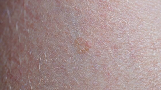F r Patient innen Und Angeh rige L DasKrebsportal de