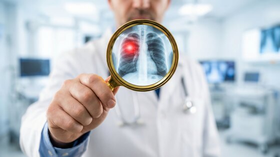 Ein Röntgenbild der Lunge unter der Lupe eines Arztes. | © AdobeStock_1889945911