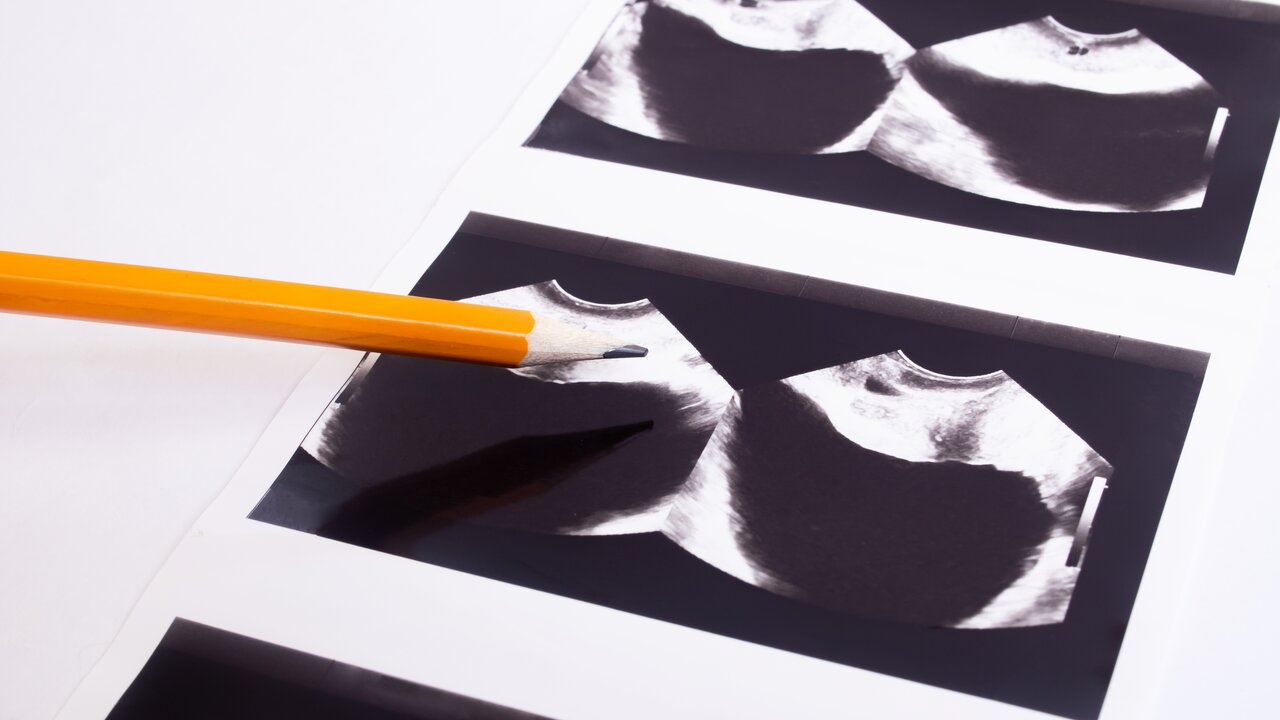 Prostatakrebs-Diagnose l DasKrebsportal.de