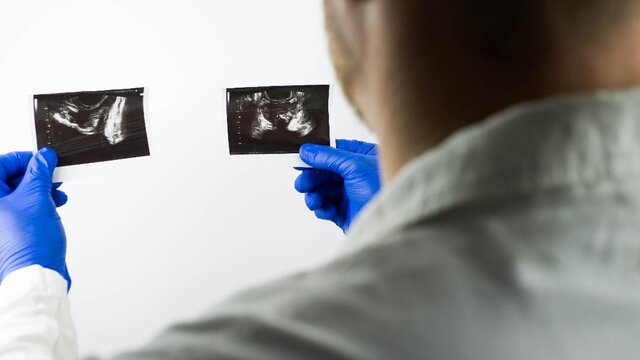 Ein Arzt vergleicht Aufnahmen der Prostata. | © AdobeStock_372532985